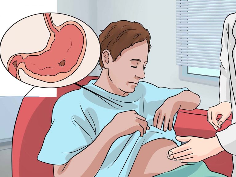 dyspepsia-indigestion-