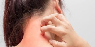 खाज-वाचा डॉ सरनोबत यांच्या टिप्स Khaj