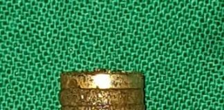 त्यांनी” शस्त्रक्रियेद्वारे बाहेर काढला पोटातील 12 चुंबकाचा संच!