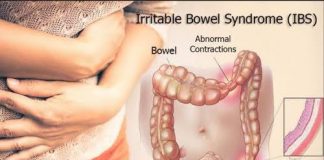 इरिटेबल बॉवेल सिंड्रोम-वाचा डॉ सोनाली सरनोबत यांच्या हेल्थ टिप्स Irritable bowell syndrome