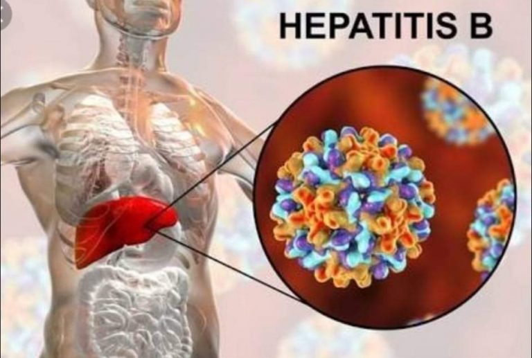 Hepatitis b