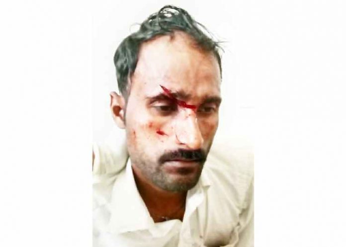 kapileshwar-bridge-belgaum-kite-thread-manja-youth-injured-yarmal-village-belgaum-202110