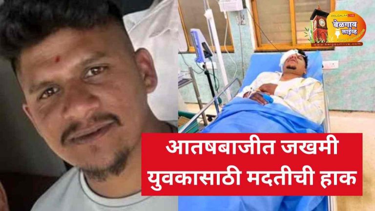 फटाक्यांच्या आतषबाजीत जखमी युवकासाठी मदतीचे आवाहन