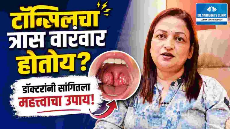 वारंवार होणारा टॉन्सिलचा त्रास कसा टाळाल?
